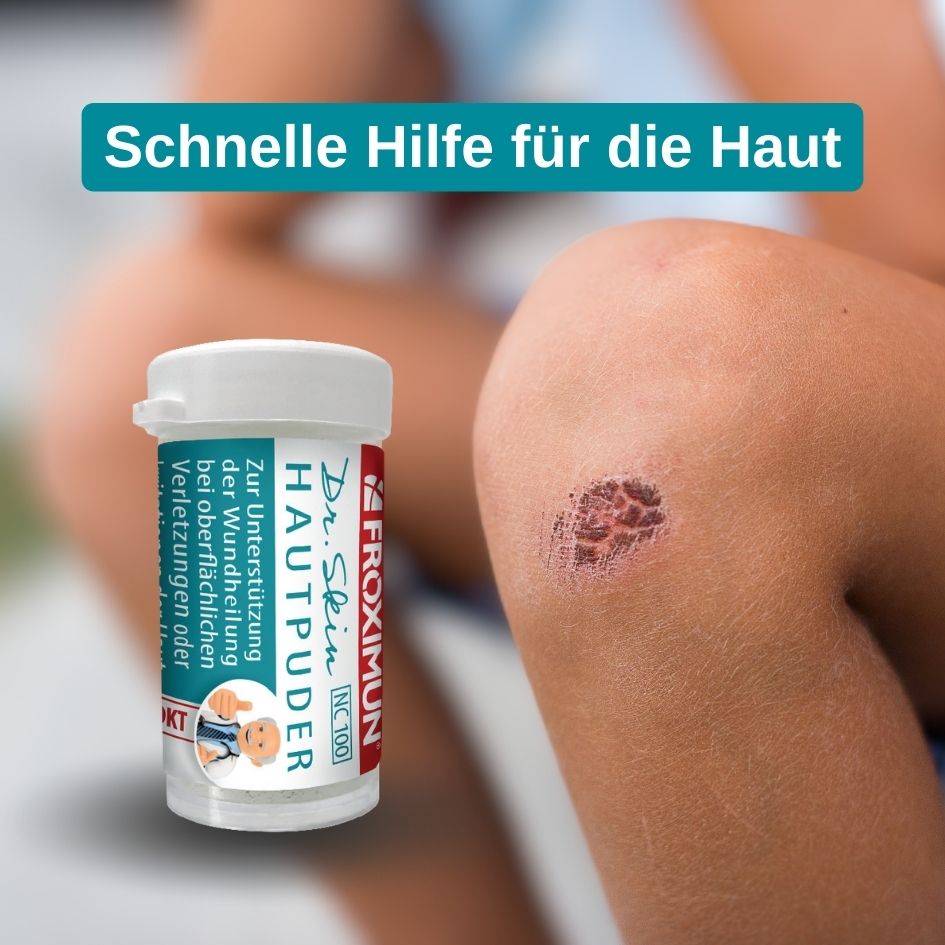 Tamino Jakobs Social Media Beispiele - Dr. Skin Hautpuder für Wundheilung